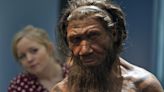 Did you have a severe case of COVID-19? Research suggests that Neanderthal genes could be to blame