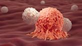 A Study Suggesting Cancer Rates Among Under-50s Have Risen Might Not Be As Straightforward As It Sounds