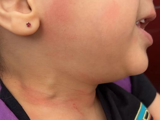 Tacoma mother says 4-year-old non-verbal daughter was choked by school bus driver