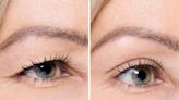 Kiss Droopy Eyes Goodbye With These Confidence-Boosting Eyelid-Lifting Strips