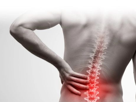 腰痛可根治！基因療法可修復椎間盤組織 - 國際