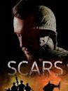 Scars