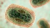 La Crosse County reports first case of Monkeypox