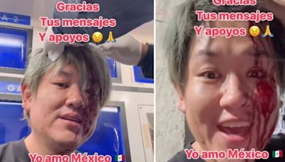 Joven japonés sufre asalto en Monterrey y se viraliza al expresar que aún así ama a México