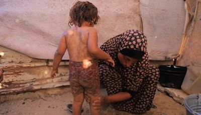 With a lack of access to aid, this mother in Gaza bathes her child with sand | CBC News