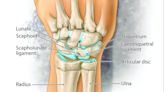Injuries and Medical Advice: Wrist Pain