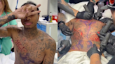 Tyga Receives Anesthesia Before 8-Hour Tattoo Session