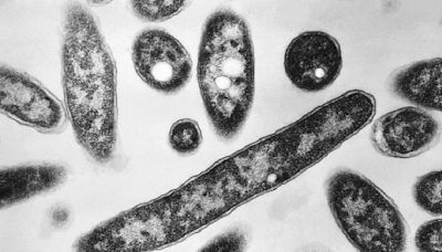 What is Legionnaires’ disease, and how does it spread?