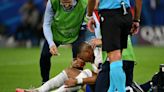 Mbappe Breaks Nose In France Euro 2024 Win