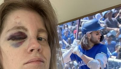 Fan beaned at Jays game to get ball signed by Bo Bichette