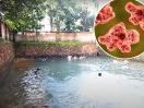 Brain-eating amoeba kills teen after he went swimming in contaminated water — third death in 2 months
