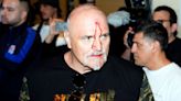 Watch: John Fury left bleeding after clash with Usyk’s team ahead of son Tyson’s unification fight