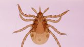 5 Signs of Lyme Disease You Really Shouldn’t Ignore