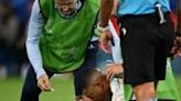 Mbappe breaks nose in France Euro 2024 win