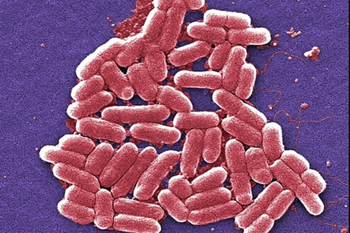 Urgent E coli health warning as more than 100 cases linked to ‘nationally distributed’ food