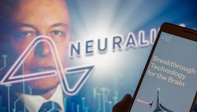 Musk says next Neuralink brain implant expected soon, despite issues with the first patient