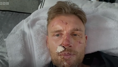 Freddie Flintoff films emotional hospital moment days after Top Gear crash