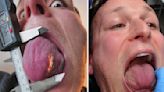 Viral video: Belgian man expands tongue to 17 centimeters to set Guinness World Record