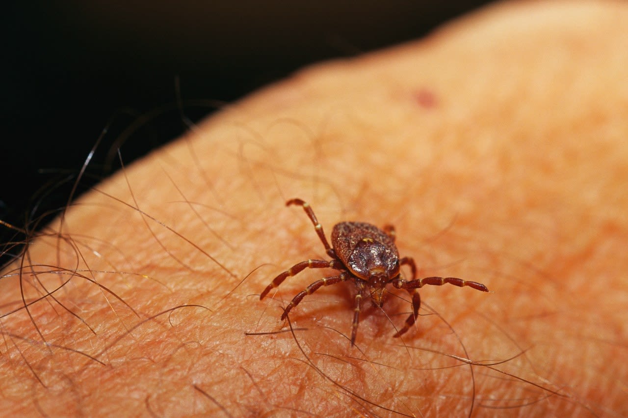 Department of Health hopes to prevent tickborne diseases with new online resource