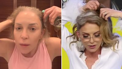 Laura Flores pone un alto a críticas por su pérdida de cabello: "La alopecia no debe avergonzar"