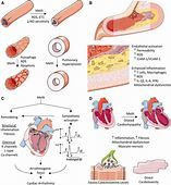 Image courtesy of ahajournals.org