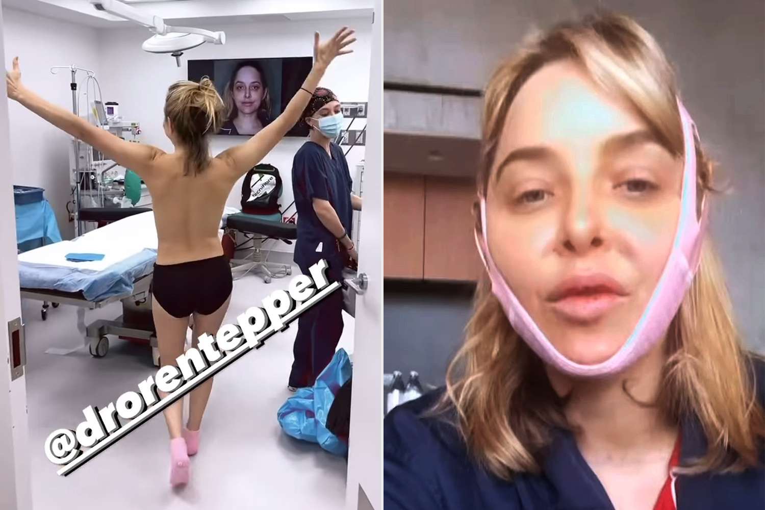 Jenny Mollen Runs Around Topless Before Documenting Breast Lift, Chin Liposuction and Fat Transfer