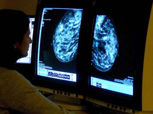 Breast cancer drug not recommended for NHS use after price talks break down