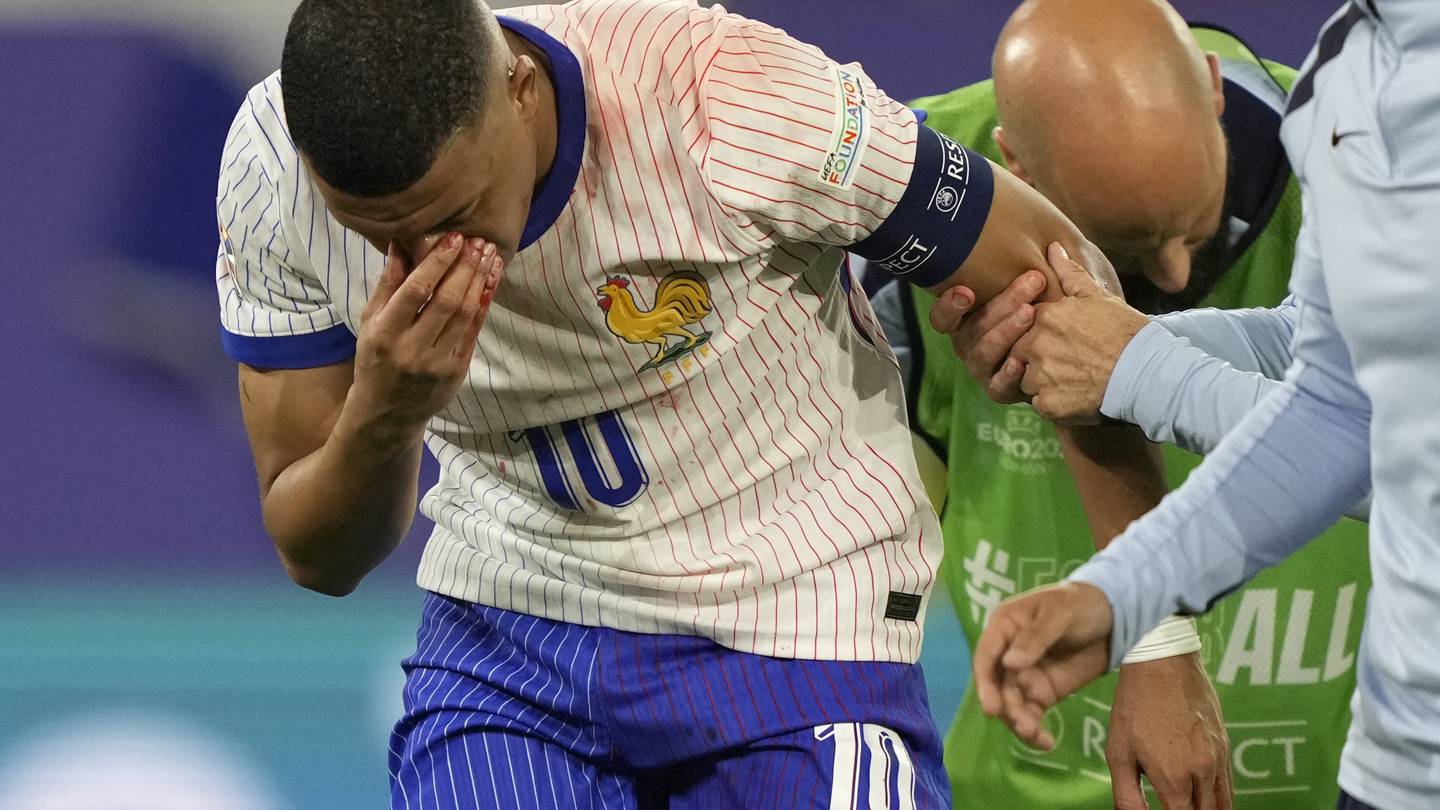 Mbappé's facial injury places doubt on his continued involvement in Euro 2024