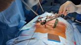 Current Trends Ruling the World of Spine Surgery Treatment- A Deep Dive - ET HealthWorld