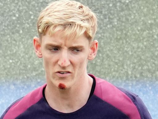 Chin up Anthony! Gordon the butt of jokes in England camp after bike fall