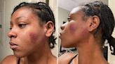 Officer initially hit woman in face before viral video showed second officer repeatedly striking her, police say