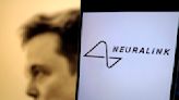 Elon Musk is inserting brain chips into people – here's what the tech can do