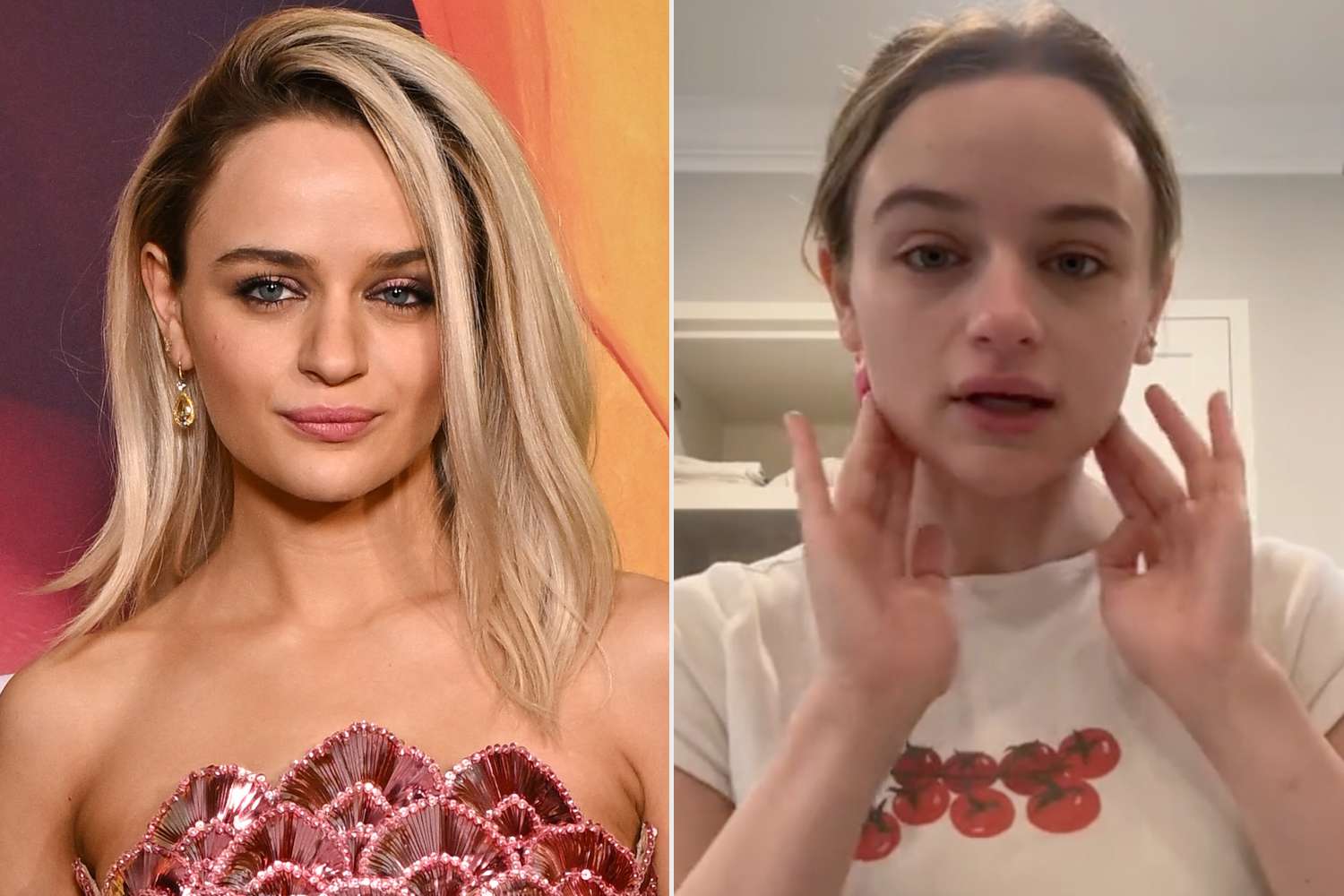 Joey King Says She's Been 'Struggling' with Perioral Dermatitis for 7 Months: 'No Idea What to Do'