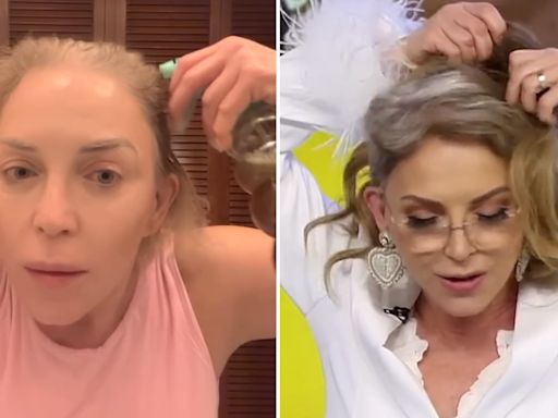 Laura Flores pone un alto a críticas por su pérdida de cabello: "La alopecia no debe avergonzar"