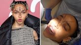 FKA Twigs Shares Photos from the Dentist and Reassures Fans She's 'Not Closing' the Gap in Her Teeth