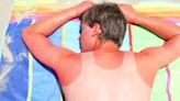 6 Ways to Soothe a Sunburn, According to Dermatologists