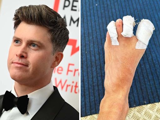 Colin Jost suffers staph infection after Olympics surfing injury: "This might ruin my WikiFeet score"