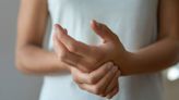 Ask a doctor: 'Why are my hands swelling and what should I do about it?'