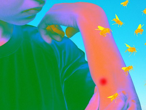 Mosquitoes, bees, ticks and more: How to treat bites and stings — and avoid bugs this summer