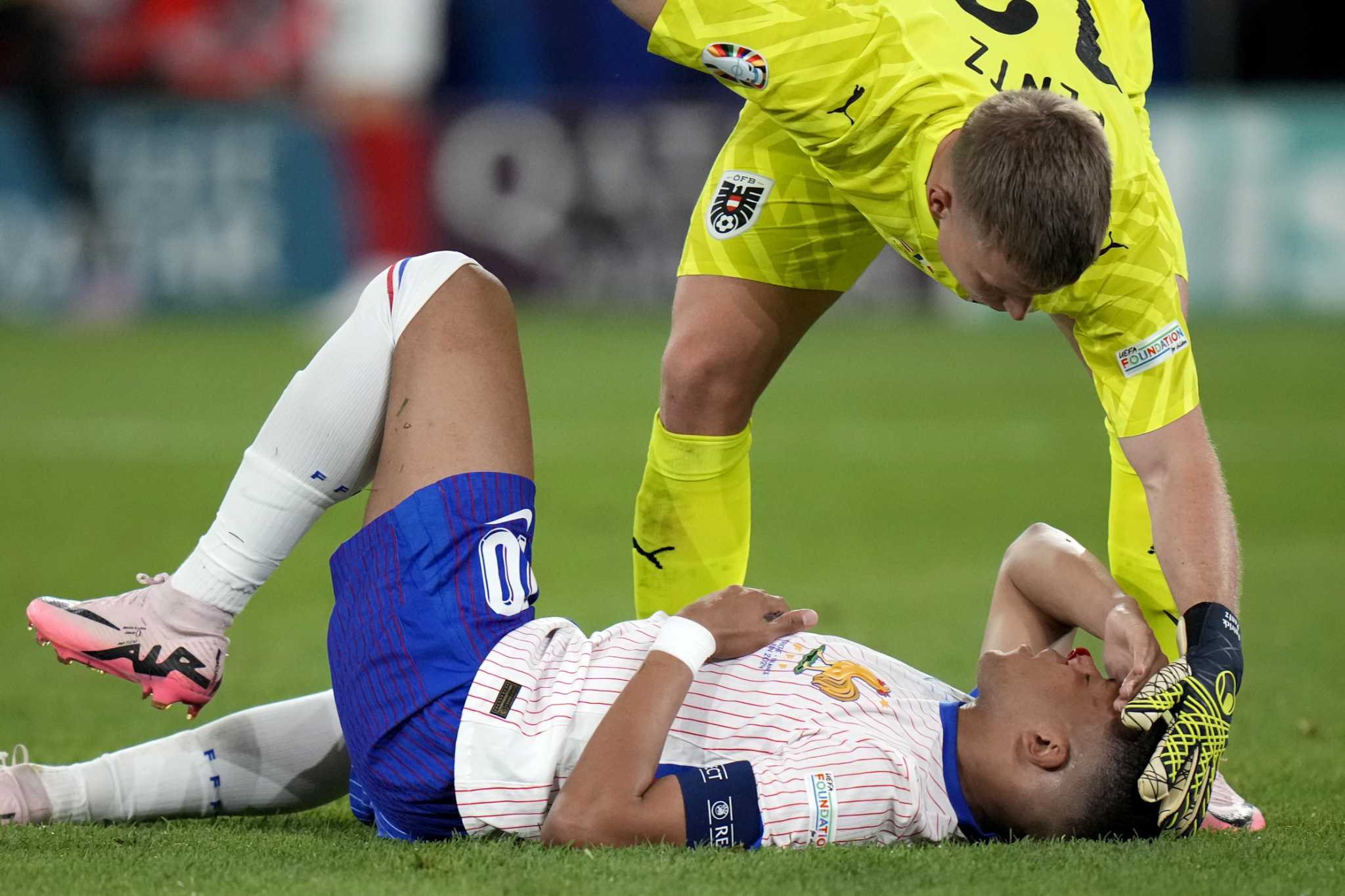 Kylian Mbappé sustained a broken nose at Euro 2024, but France gets 'positive' news