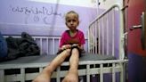 Gaza mothers search for milk as malnutrition hits | Fox 11 Tri Cities Fox 41 Yakima