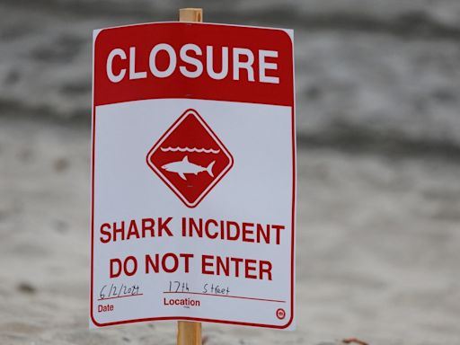 4 Texas beachgoers attacked by 6-feet long shark on Fourth of July