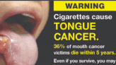 Health Canada just added tongue cancer to its cigarette packs — what to know about the disease