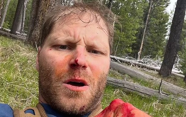 Veteran survives bear attack after animal accidentally bit spray can