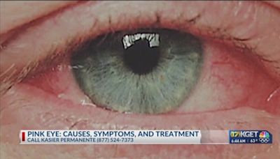 Pink Eye: Causes, symptoms and treatments