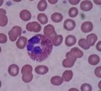 Eosinophil