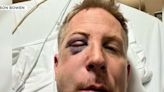 Golden Knights fan searching for man who punched him, sent him to hospital after Dallas game
