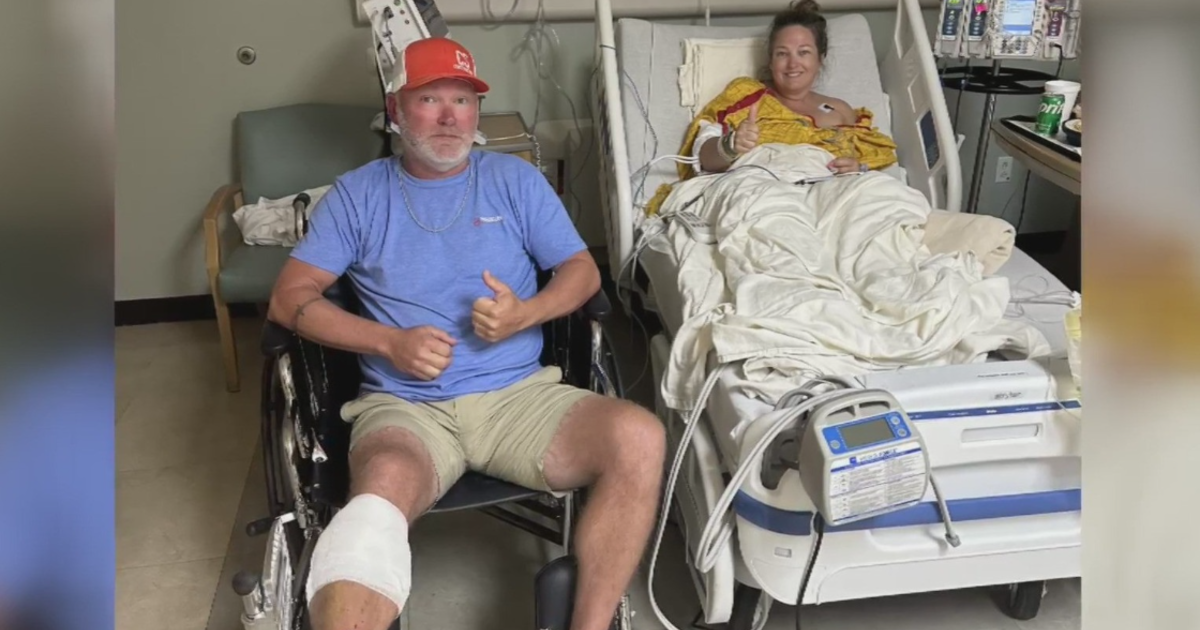 North Texas woman recalls horrifying shark attack on South Padre Island