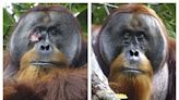 Orangutans can teach us plenty about medicine