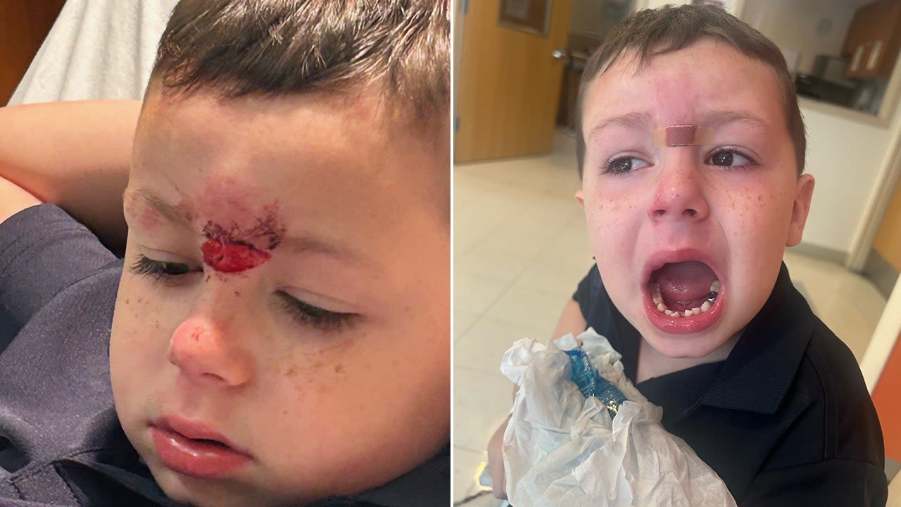Pennsylvania dad demands answers after son, 5, has teeth knocked out in bloody assault at school, lawyer says